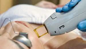 آیا لیزر غیرتماسی امن‌تر است؟